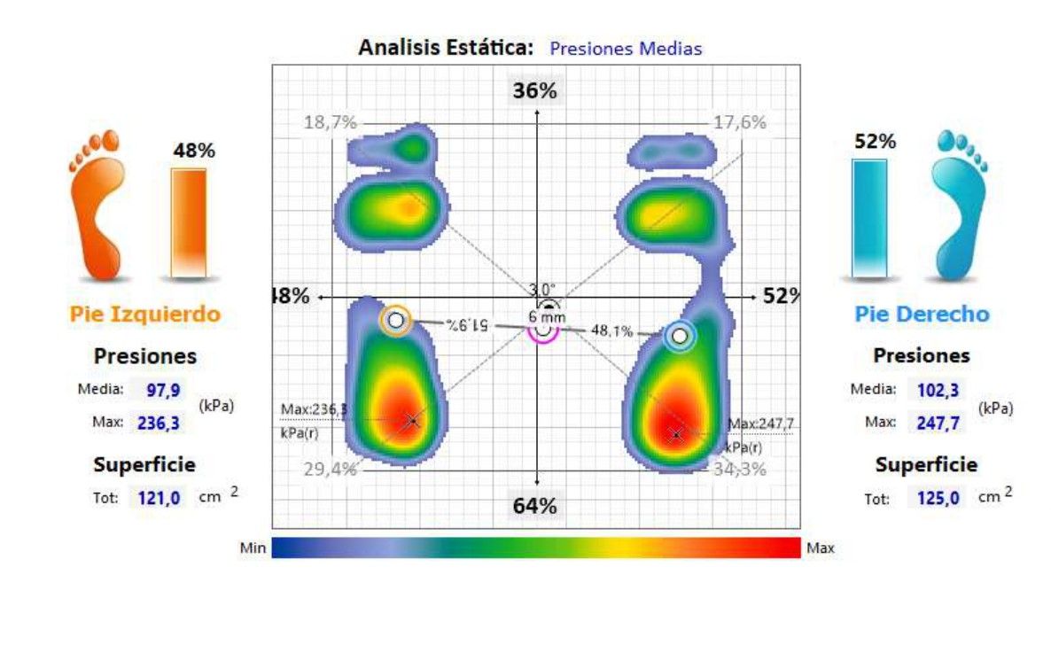 Estudio biomecánico de presiones