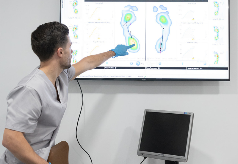 Estudio avanzado de la pisada biomecánica